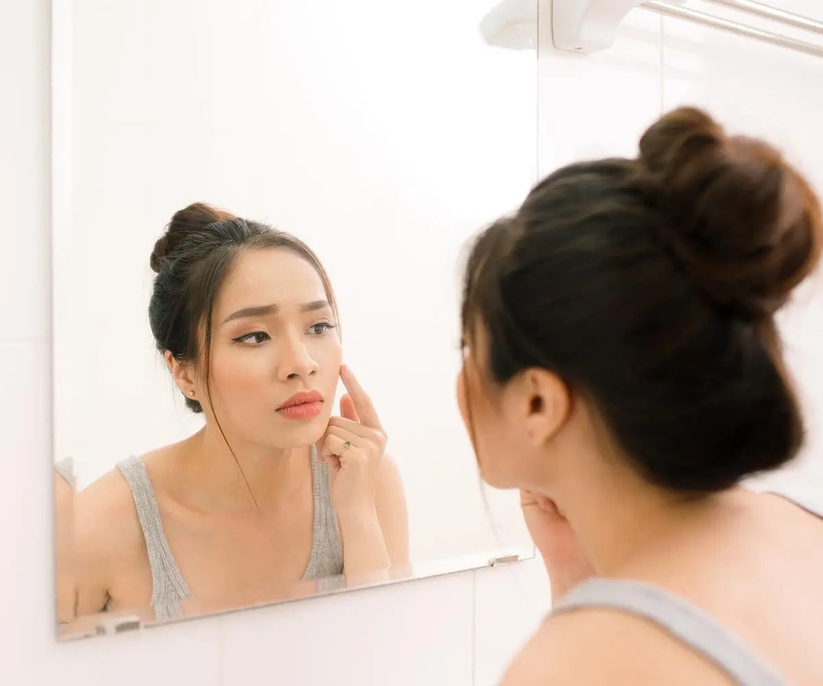Comment reconnaître et soigner l’acné hormonale ?