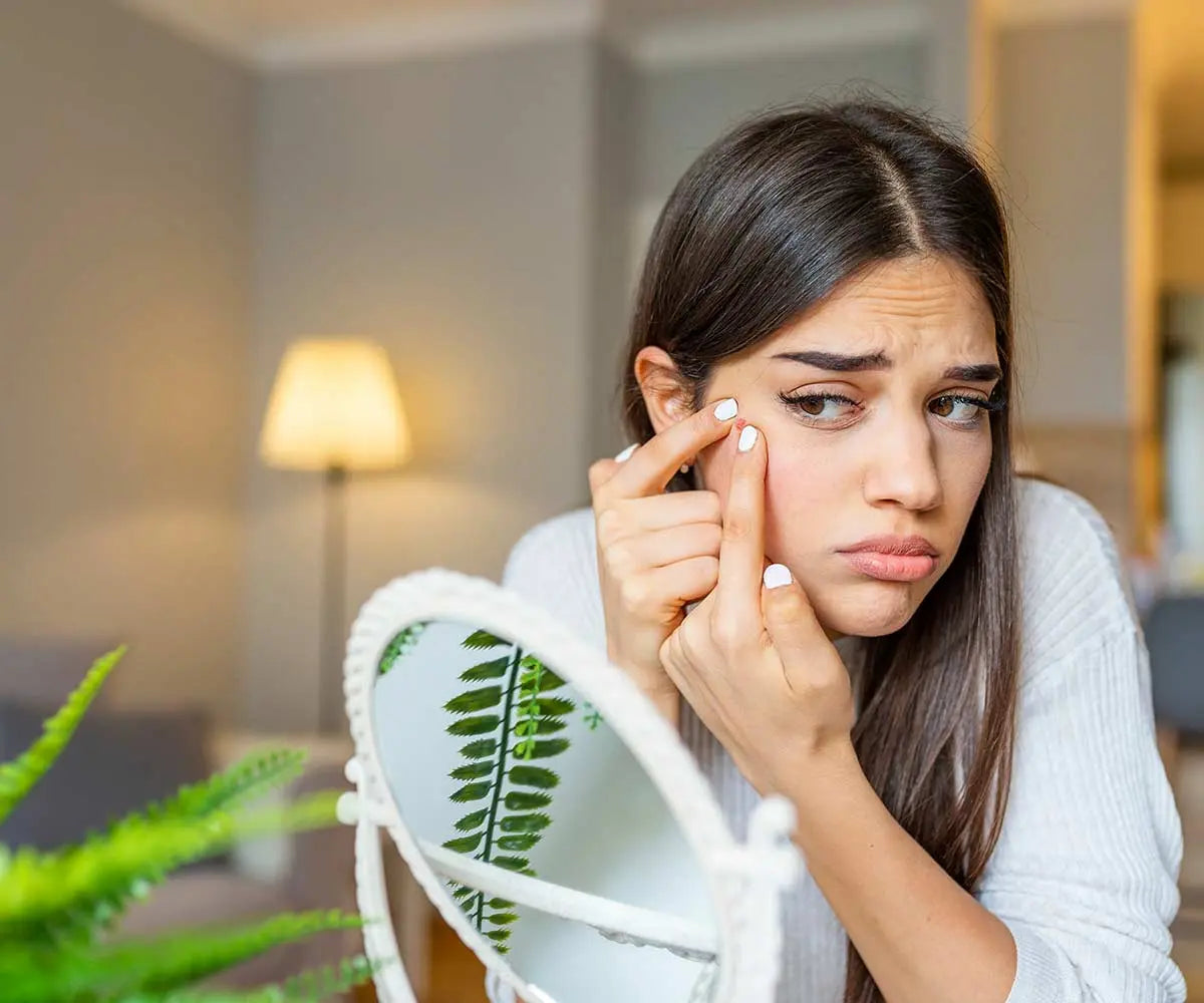 Les boutons sur le visage : on vous explique tout