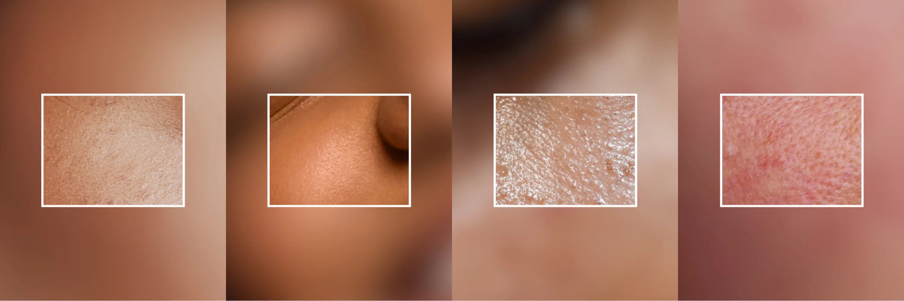 Tous nos soins par type de peau