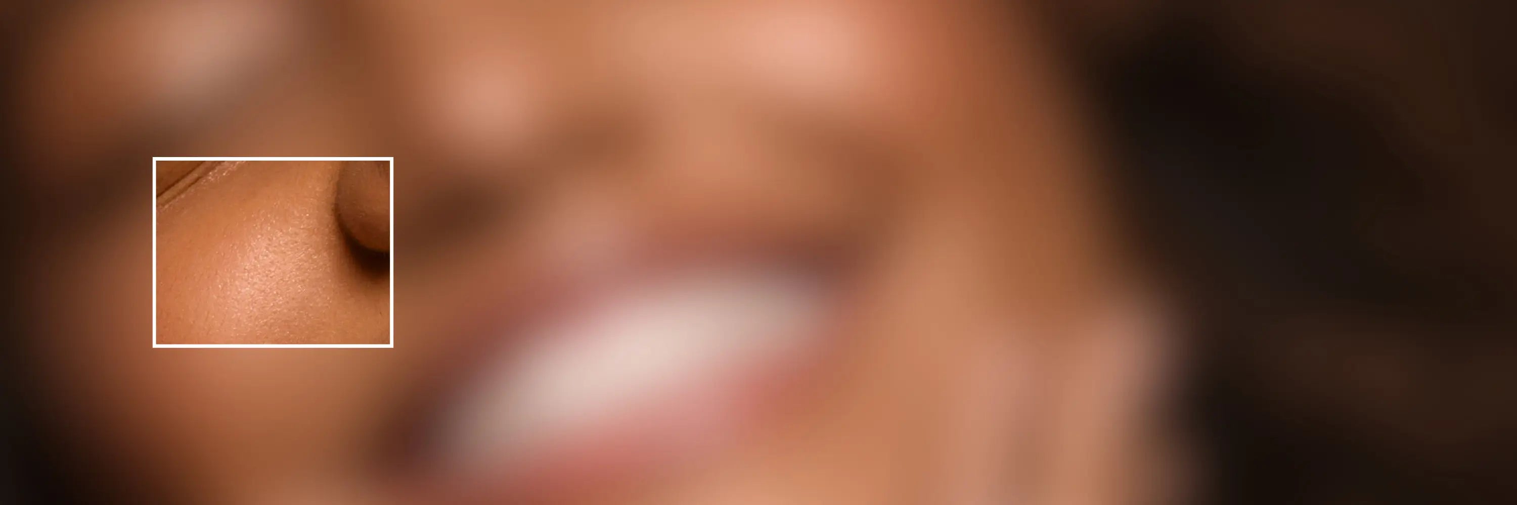 Peau normale & équilibrée