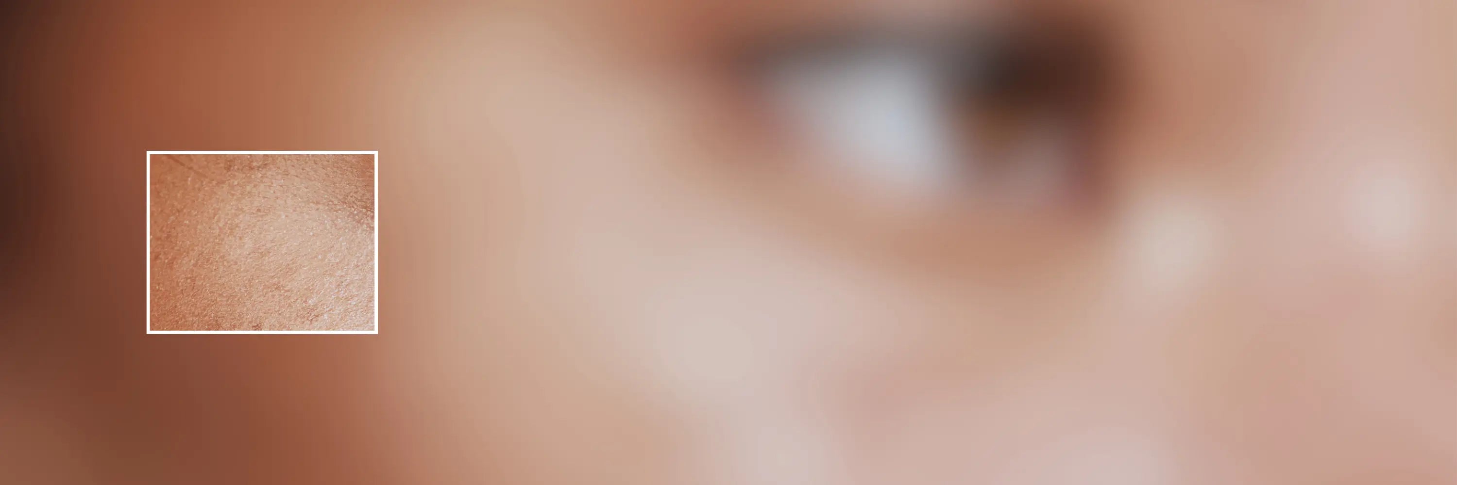 Peau sèche & déshydratée