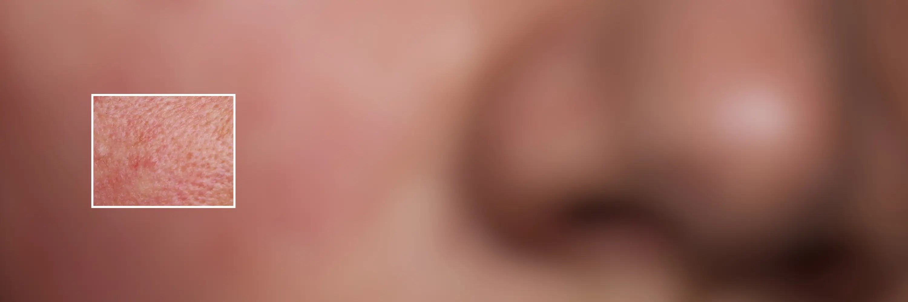 Peau sensible & réactive