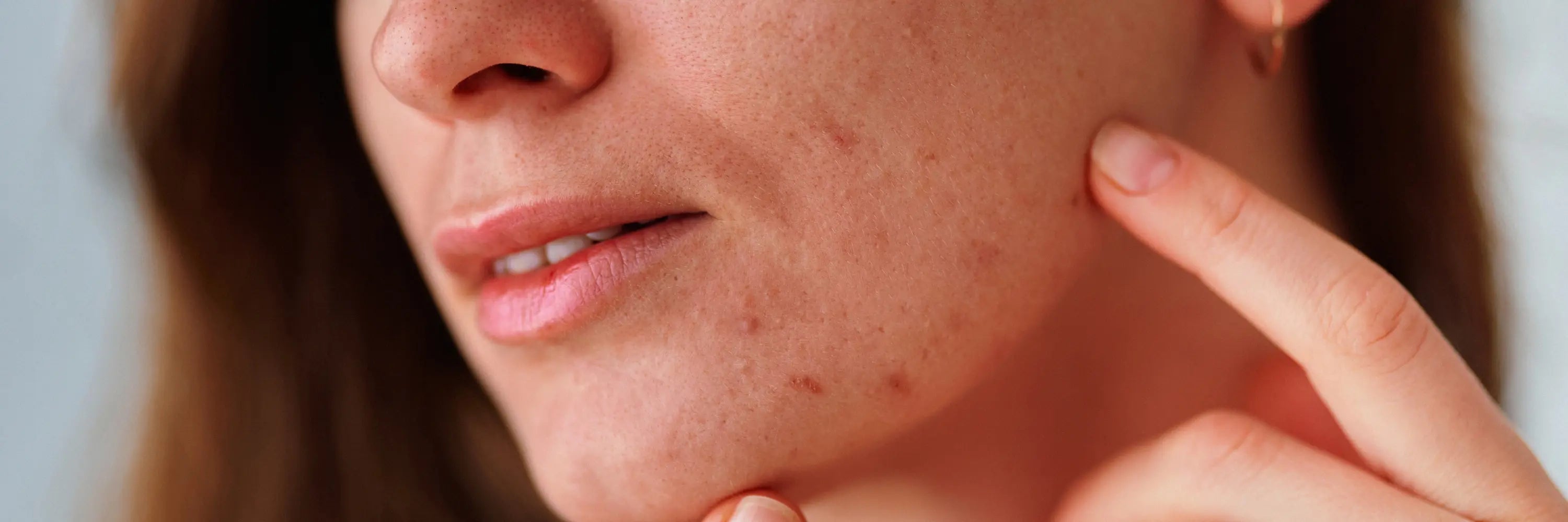 Anti-Imperfections & Peau Parfaite (Musaclean & Musalis)